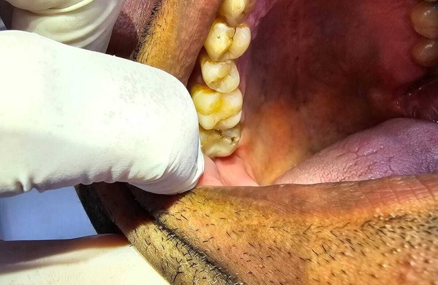 Imbassai , Residencial Ykutiba Resort, beachfront paradise